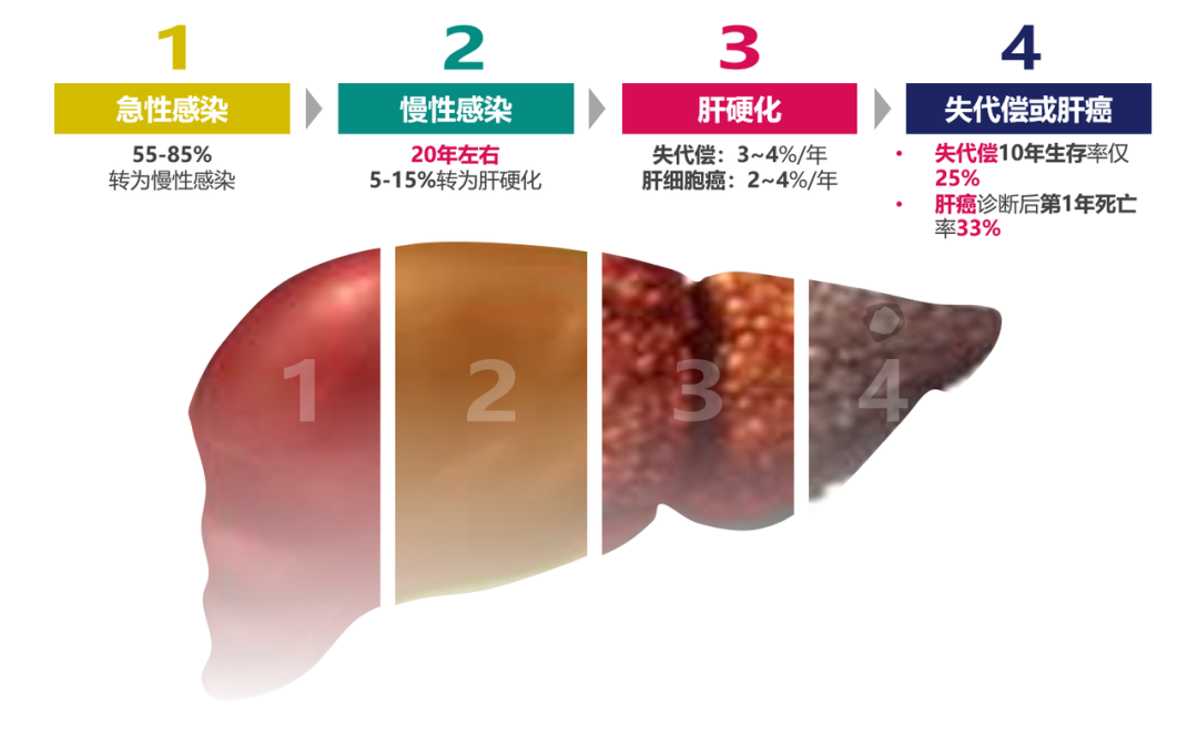 悄悄变成肝硬化、肝癌，很多人感染了却不知道